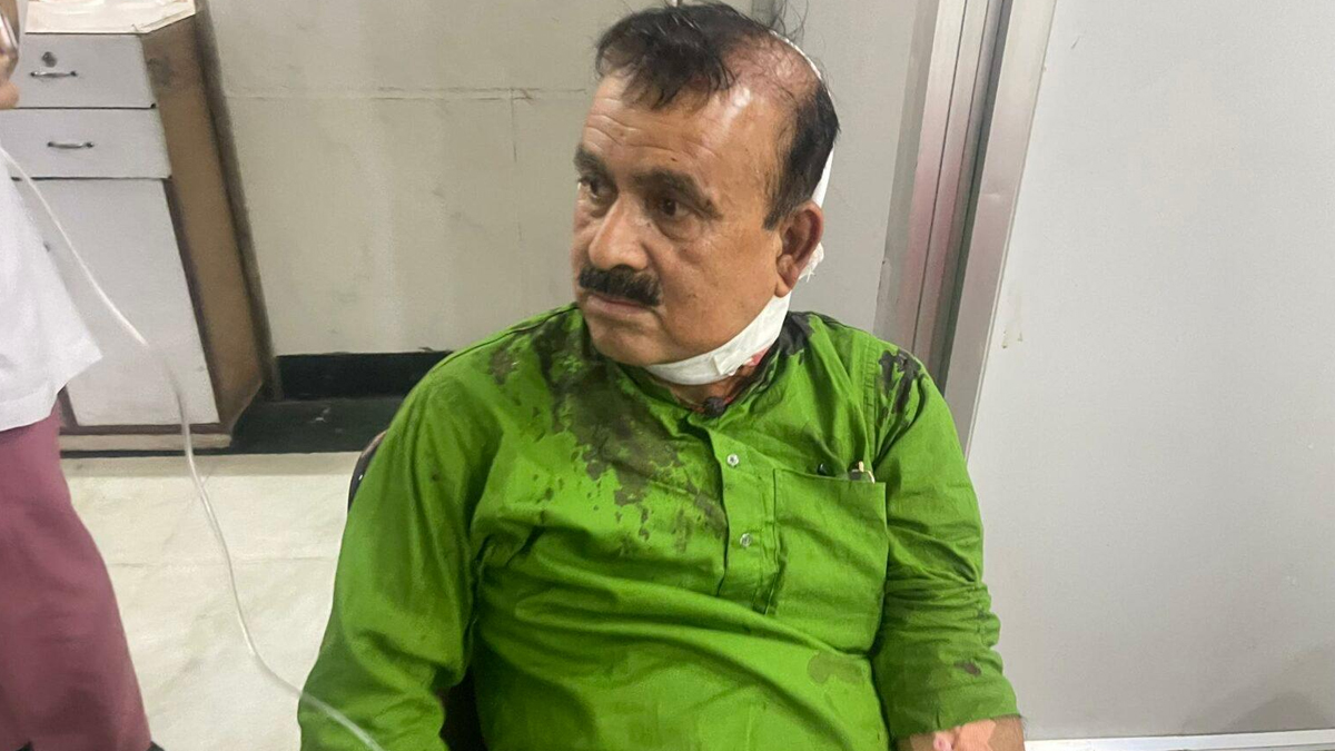कांग्रेस सहमहामन्त्री आईसियूमा राखेर थप उपचार गरिँदै
